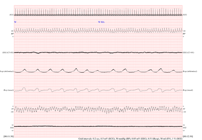 sample waveforms
