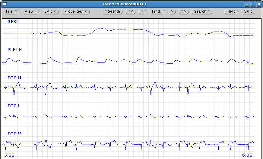 Image waveform_record