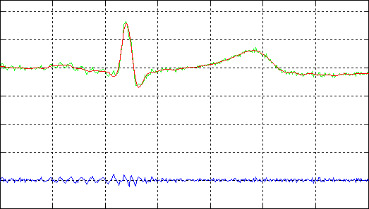 [ECG filtering 2]