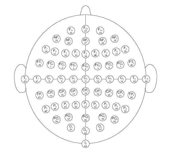 figure showing placement of electrodes