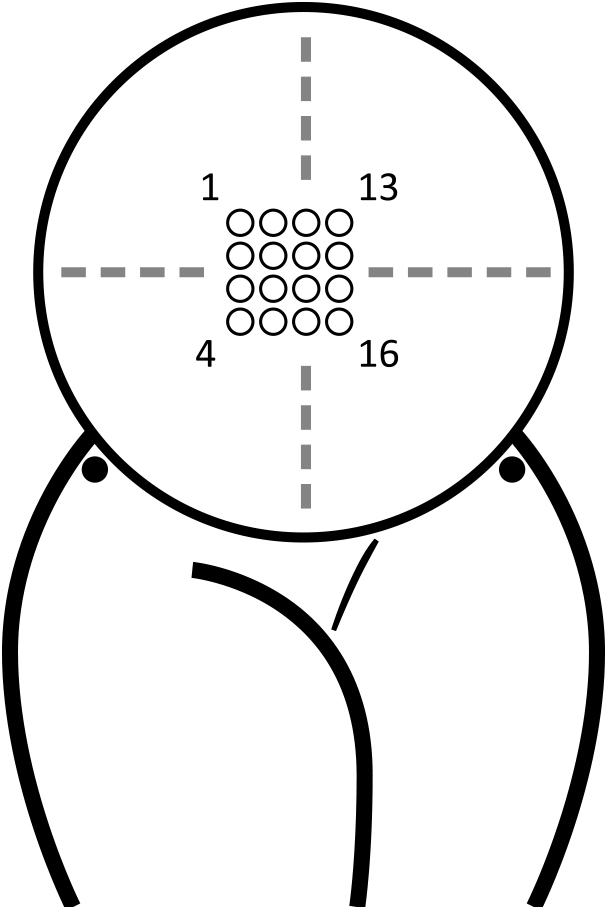 electrode positions