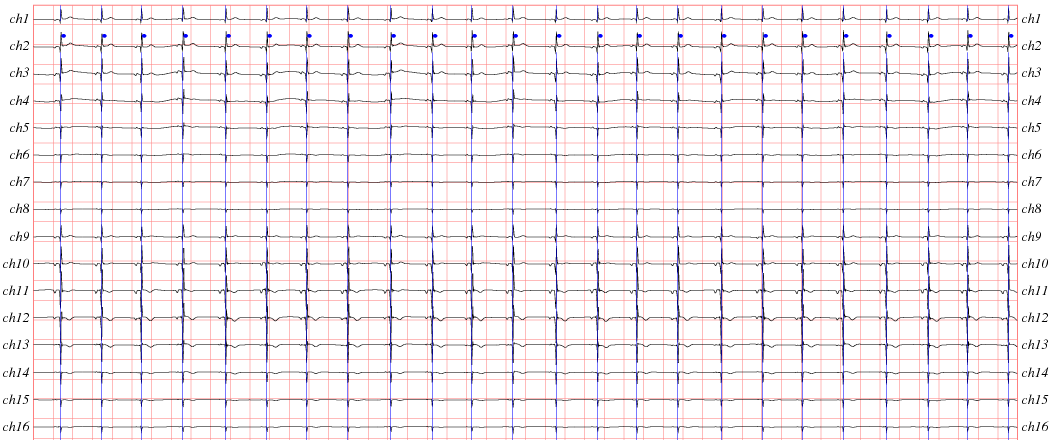 [ sample signals ]
