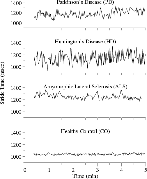 [Examples of Gait Time Series]
