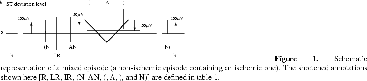 \begin{figure}%%episode representation
\begin{picture}(330,85)(0,0)
\unitlength ...
...n here [R, LR, IR, (N, AN, (, A, ), and N)] are
defined in table 1.
\end{figure}