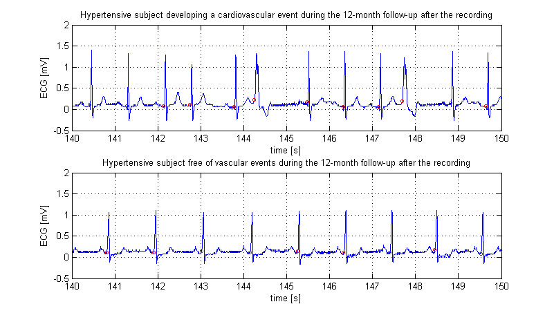 sample waveforms