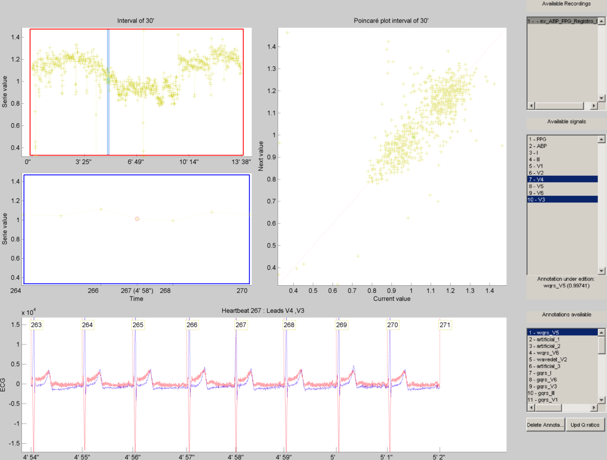 _images/QRS_corrector.PNG
