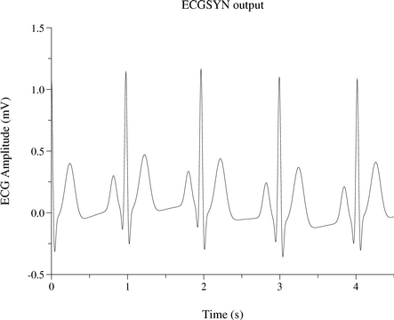 [ECGSYN output]
