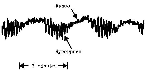 [EDR and PRT signals]