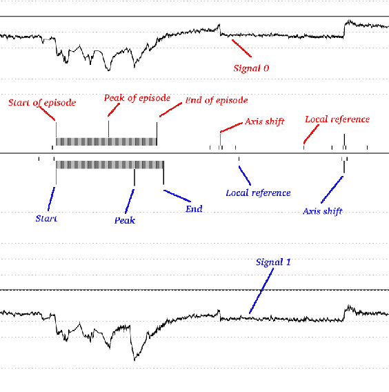 [LTSTDB plot legend]