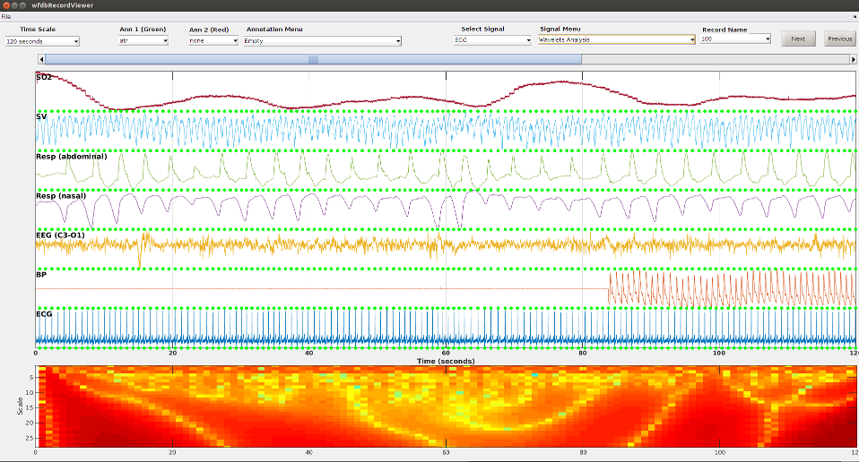 [screenshot of wfdbRecordViewer]