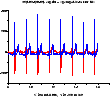 \epsfig{file=ecg,height=2cm}