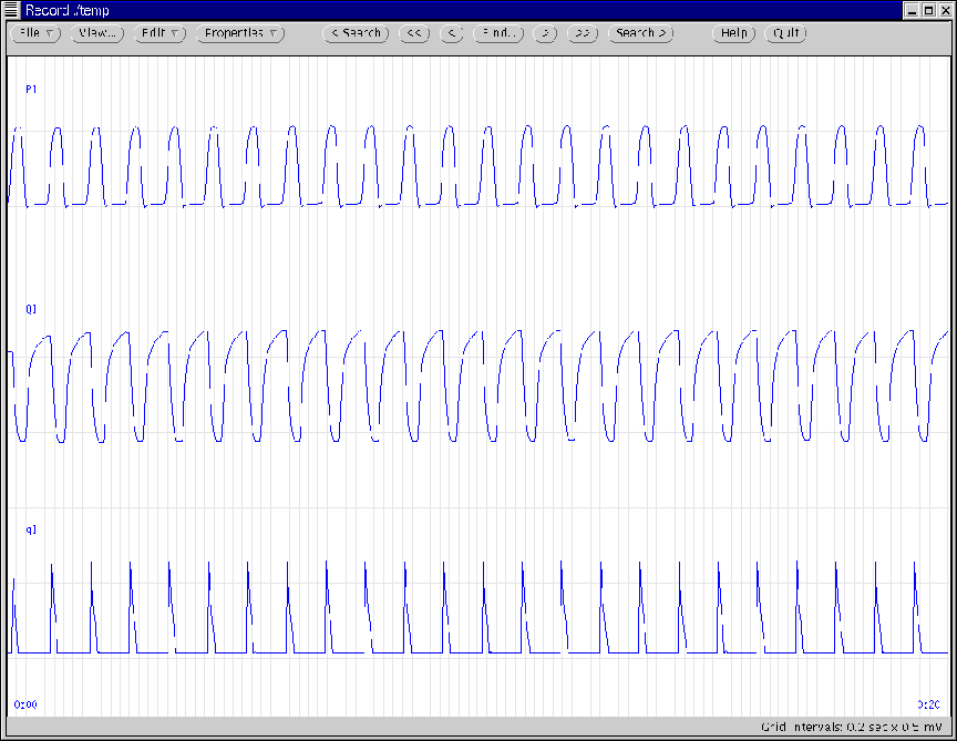 \begin{figure}\vspace{1.9in}
\centerline{\psfig{figure={epsfig/lvwave.eps},width=6in,silent=1}} \end{figure}