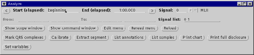 \begin{figure}\centerline{\epsfig{file=analyze-window}}\index{Analyze window@{\sf Analyze} window}
\end{figure}