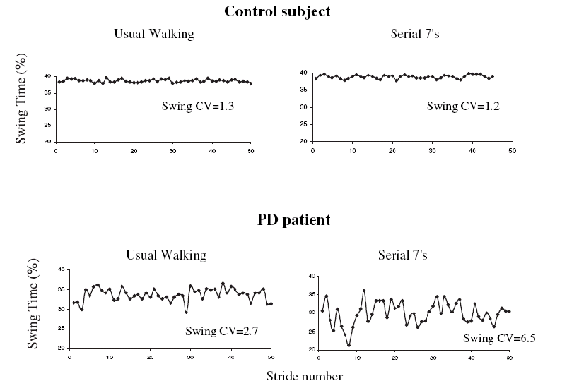 swing time series