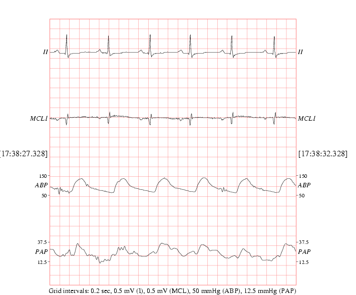 Image Waveform_data