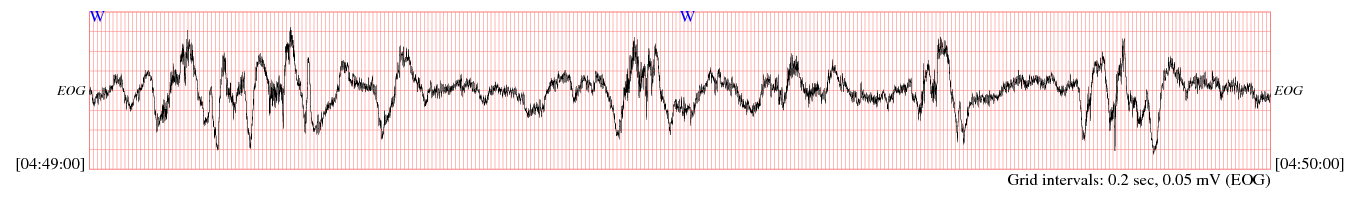 sample waveform
