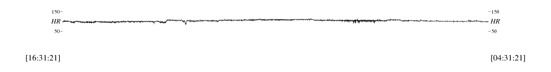 sample waveform