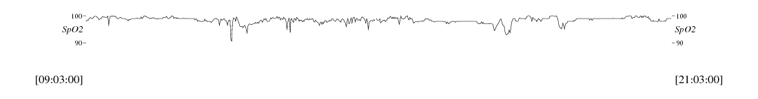 sample waveform
