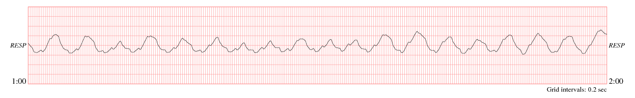 sample waveform