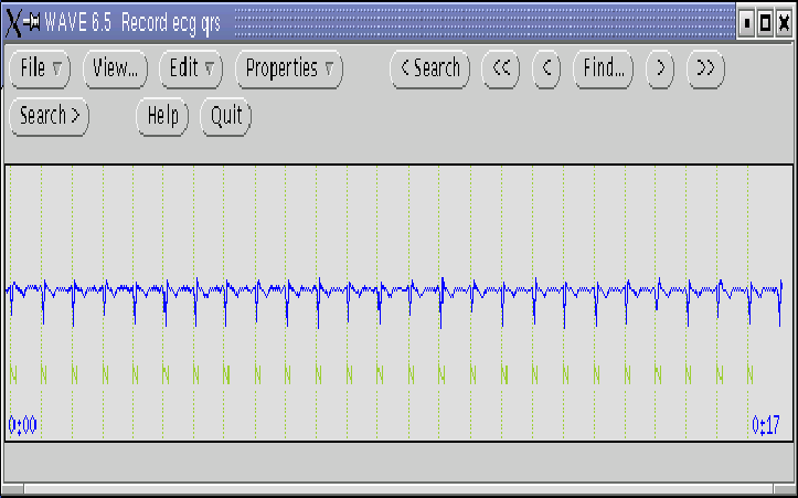 \begin{figure}\begin{center}
\epsfig{file=figures/wave.ps,width=16cm,height=10cm }\end{center}\end{figure}