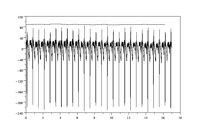\begin{figure}\begin{center}
\epsfig{file=figures/ecg.eps,width=16cm,height=10cm }\end{center}\end{figure}