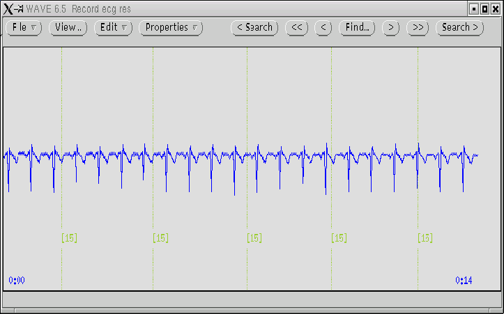 \begin{figure}\begin{center}
\epsfig{file=figures/res_in_wave.eps,width=16cm,height=10cm }\end{center}\end{figure}