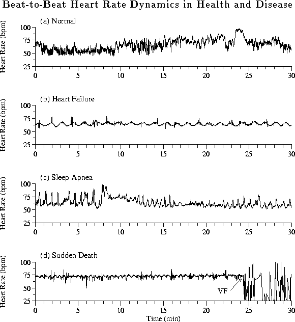 figure30
