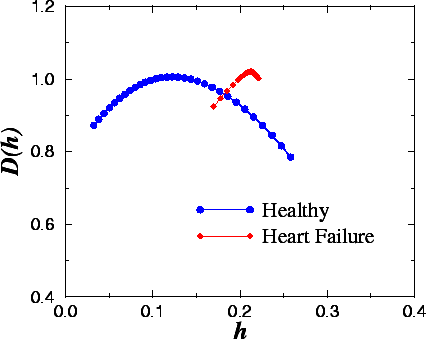 Local Holder exponent: Heart rate